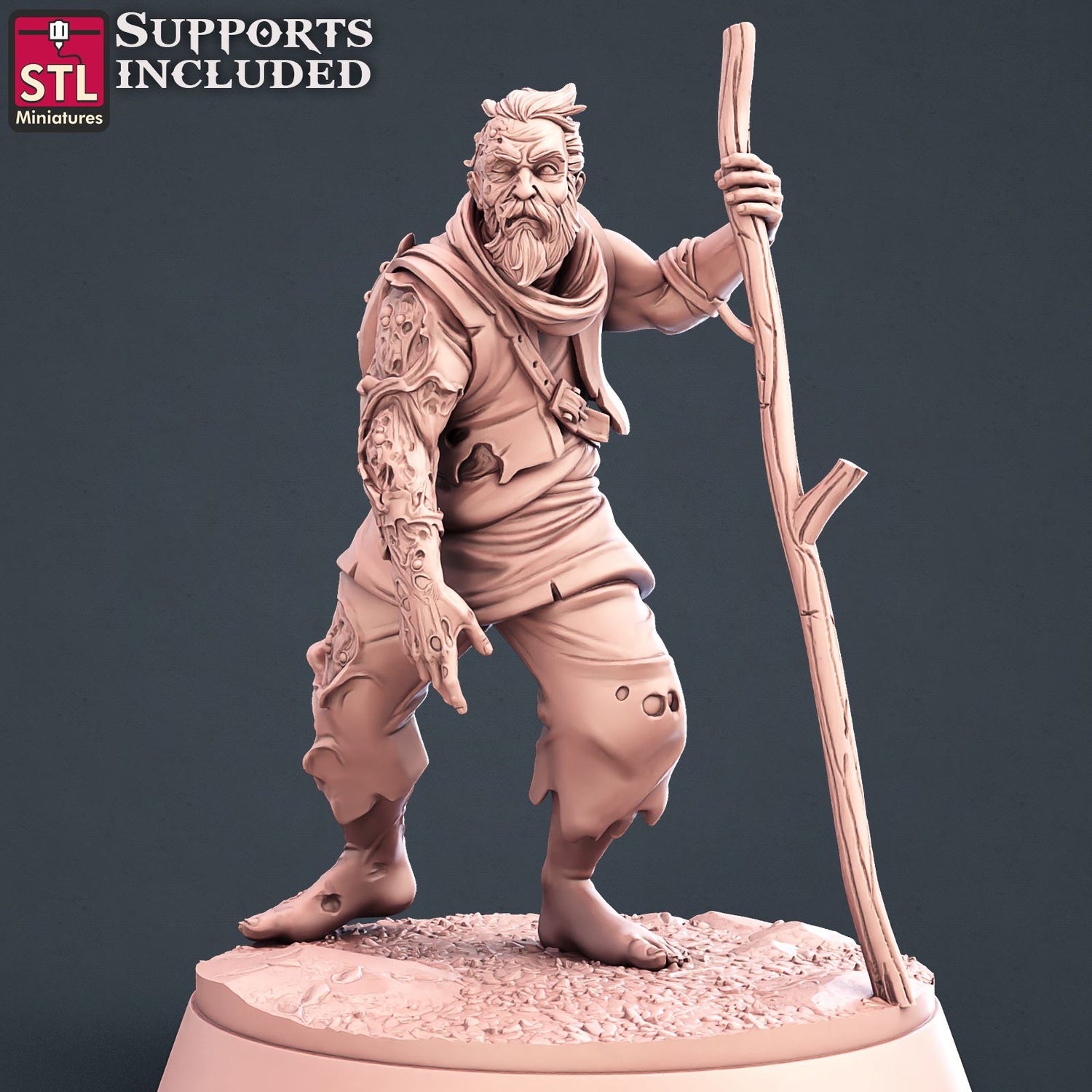 Injured Villager A Scale Models STLMiniatures